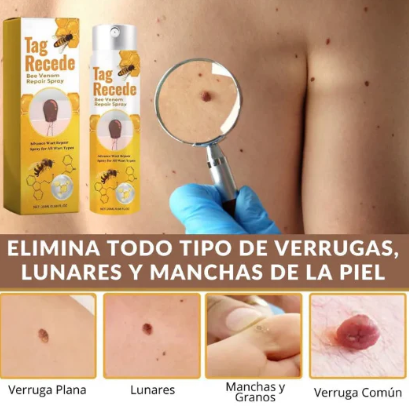 Eliminador de Verrugas y Lunares TagRecede