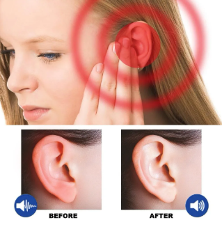 TINNIDROP | SPRAY PARA EL ALIVIO Y LIMPIEZA PROFUNDA DE LOS OÍDOS